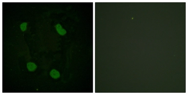 Anti-Histone H3K14ac (Acetyl Lys14) antibody used in Immunocytochemistry/ Immunofluorescence (ICC/IF). GTX88008