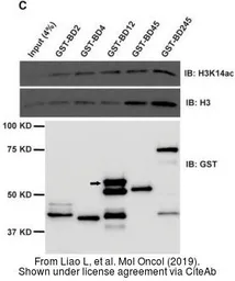 Anti-Histone H3K14ac (Acetyl Lys14) antibody used in Western Blot (WB). GTX88008