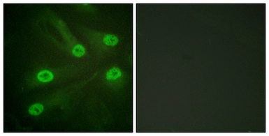 Anti-p53 (acetyl Lys386) antibody used in Immunocytochemistry/ Immunofluorescence (ICC/IF). GTX88009