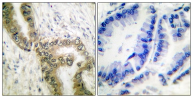 Anti-p53 (acetyl Lys386) antibody used in IHC (Paraffin sections) (IHC-P). GTX88009