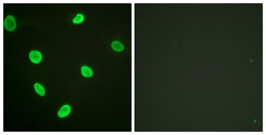 Anti-Histone H2BK12ac (acetyl Lys12) antibody used in Immunocytochemistry/ Immunofluorescence (ICC/IF). GTX88011