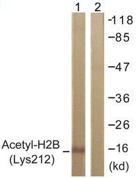 Anti-Histone H2BK12ac (acetyl Lys12) antibody used in Western Blot (WB). GTX88011