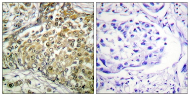 Anti-p53 (acetyl Lys379) antibody used in IHC (Paraffin sections) (IHC-P). GTX88013