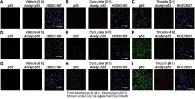 Anti-p53 (acetyl Lys379) antibody used in Immunocytochemistry/ Immunofluorescence (ICC/IF). GTX88013