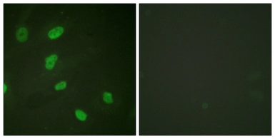 Anti-Histone H2BK5ac (acetyl Lys5) antibody used in Immunocytochemistry/ Immunofluorescence (ICC/IF). GTX88015