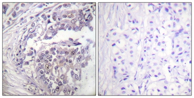 Anti-Histone H2BK5ac (acetyl Lys5) antibody used in IHC (Paraffin sections) (IHC-P). GTX88015