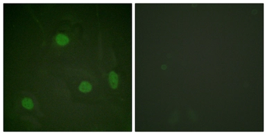 Anti-Histone H3K23ac (Acetyl Lys23) antibody used in Immunocytochemistry/ Immunofluorescence (ICC/IF). GTX88017