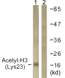 Anti-Histone H3K23ac (Acetyl Lys23) antibody used in Western Blot (WB). GTX88017