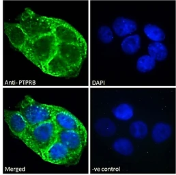 Anti-PTPRB antibody, Internal used in Immunocytochemistry/ Immunofluorescence (ICC/IF). GTX88020