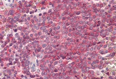 Anti-SNAP23 antibody, Internal used in IHC (Paraffin sections) (IHC-P). GTX88021