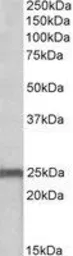 Anti-NDUFS8 antibody, Internal used in Western Blot (WB). GTX88022