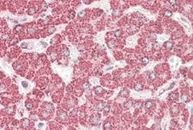 Anti-ETFB (aa 231-243) antibody, C-term used in IHC (Paraffin sections) (IHC-P). GTX88024
