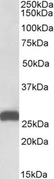 Anti-ETFB (aa 231-243) antibody, C-term used in Western Blot (WB). GTX88024