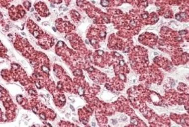 Anti-ETFB (aa 152-165) antibody, Internal used in IHC (Paraffin sections) (IHC-P). GTX88025