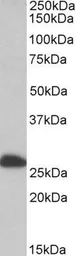 Anti-ETFB (aa 152-165) antibody, Internal used in Western Blot (WB). GTX88025
