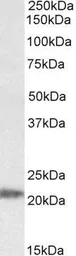 Anti-IMP3 antibody, Internal used in Western Blot (WB). GTX88026
