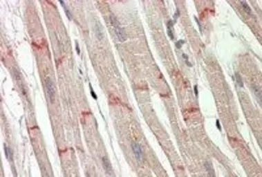 Anti-Desmoplakin (aa 1672 -1684) antibody, Internal used in IHC (Paraffin sections) (IHC-P). GTX88029