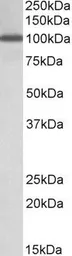 Anti-NUP107 antibody, Internal used in Western Blot (WB). GTX88032