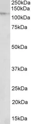 Anti-NUP107 antibody, Internal used in Western Blot (WB). GTX88032