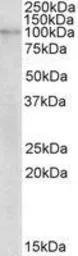 Anti-NLRX1 antibody, Internal used in Western Blot (WB). GTX88038