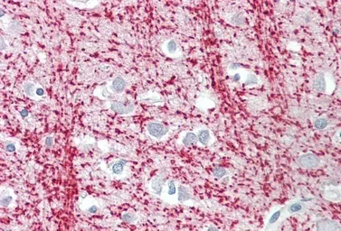 Anti-TPPP antibody, Internal used in IHC (Paraffin sections) (IHC-P). GTX88044