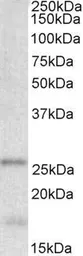 Anti-TPPP antibody, Internal used in Western Blot (WB). GTX88044