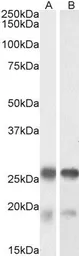 Anti-TPPP antibody, Internal used in Western Blot (WB). GTX88044