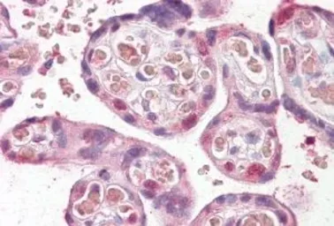 Anti-FANCE antibody, Internal used in IHC (Paraffin sections) (IHC-P). GTX88047