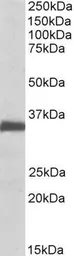 Anti-Ephrin B2 antibody, Internal used in Western Blot (WB). GTX88049
