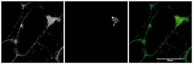 Anti-MYO5A antibody, Internal used in Immunohistochemistry (IHC). GTX88050
