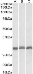 Anti-PSMA4 antibody, Internal used in Western Blot (WB). GTX88053