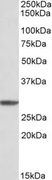 Anti-PSMA4 antibody, Internal used in Western Blot (WB). GTX88053