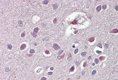 Anti-ARHGDIG antibody, C-term used in IHC (Paraffin sections) (IHC-P). GTX88058