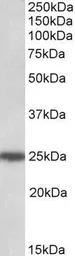 Anti-ARHGDIG antibody, C-term used in Western Blot (WB). GTX88058