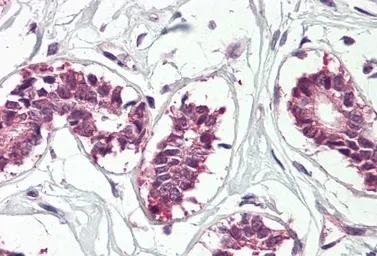 Anti-IGF2BP1 antibody, Internal used in IHC (Paraffin sections) (IHC-P). GTX88062