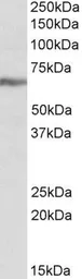 Anti-IGF2BP1 antibody, Internal used in Western Blot (WB). GTX88062