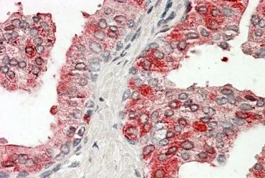 Anti-Prostatic Acid Phosphatase antibody, Internal used in IHC (Paraffin sections) (IHC-P). GTX88063