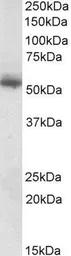 Anti-Copine 1 antibody, C-term used in Western Blot (WB). GTX88066