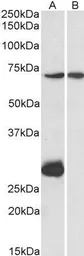 Anti-CPT2 (aa141-154) antibody, Internal used in Western Blot (WB). GTX88067