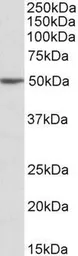 Anti-MON1A antibody, Internal used in Western Blot (WB). GTX88071
