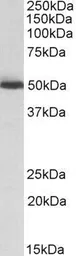 Anti-ALDH2 antibody, Internal used in Western Blot (WB). GTX88073
