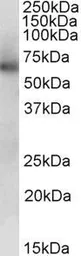 Anti-ALDH1B1 antibody, Internal used in Western Blot (WB). GTX88077