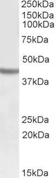 Anti-SOX3 antibody, C-term used in Western Blot (WB). GTX88078