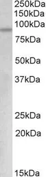 Anti-c-Myb (aa557-569) antibody, Internal used in Western Blot (WB). GTX88080