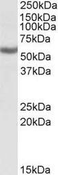 Anti-ALDH3B1 antibody, Internal used in Western Blot (WB). GTX88081