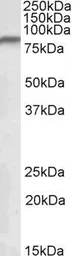 Anti-NDUFS1 antibody, Internal used in Western Blot (WB). GTX88087