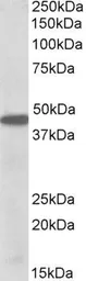 Anti-PBX1 antibody, Internal used in Western Blot (WB). GTX88088
