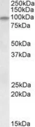 Anti-DAG1 antibody, Internal used in Western Blot (WB). GTX88089