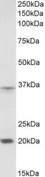 Anti-HOXA9 antibody, Internal used in Western Blot (WB). GTX88092