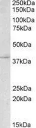 Anti-Myogenin antibody, C-term used in Western Blot (WB). GTX88097
